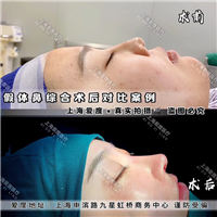 上海爱度整形何世硕 