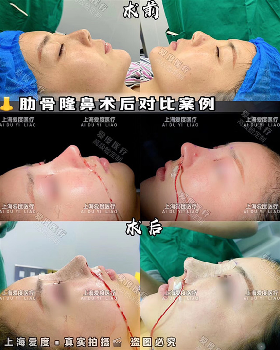 上海何世硕 