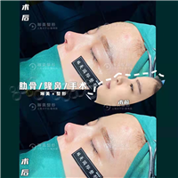 上海鼻综合整形哪家好