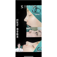 上海琳美腰腹环吸精雕术