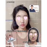 上海磨骨整形