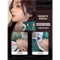 上海磨骨整形