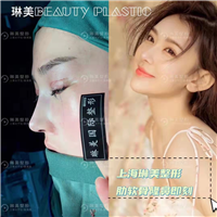上海琳美肋软骨隆鼻