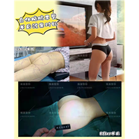 上海琳美自体脂肪丰臀