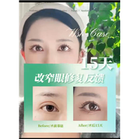 上海圣娅整形