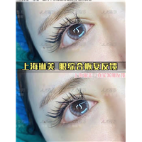 上海琳美眼综合案例
