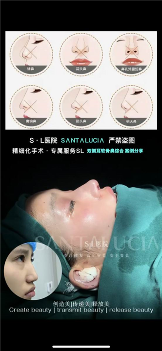 上海琳美鼻整形