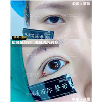 上海琳美国际招牌眼综合整形