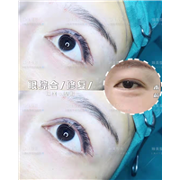 上海眼综合修复