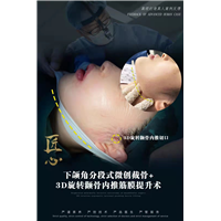 上海磨骨整形医院
