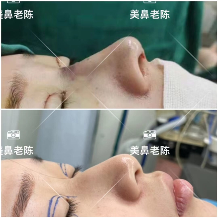 上海鼻王整形