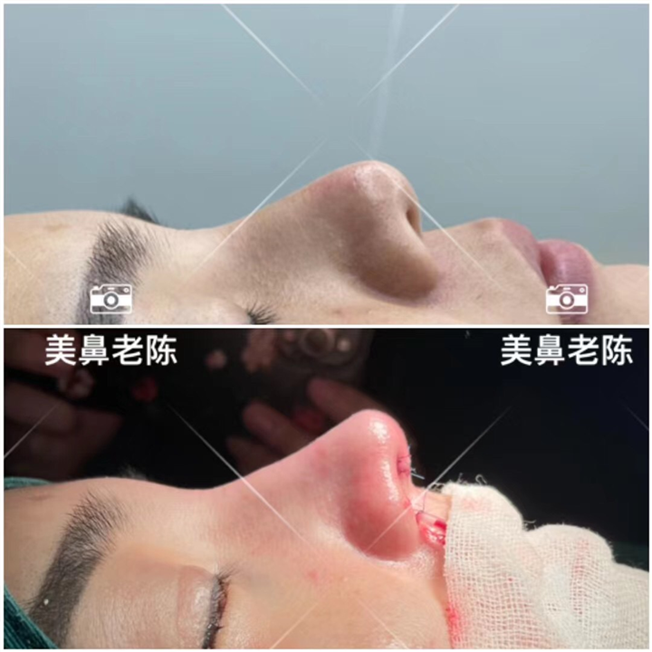 上海陈坚医生