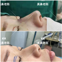 上海鼻王医生