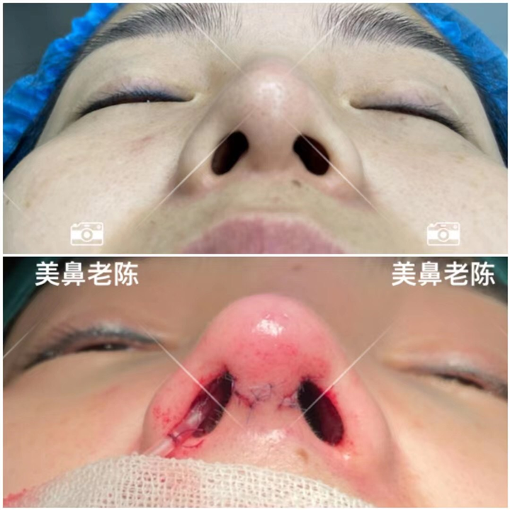 陈坚院长