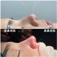 陈坚医生