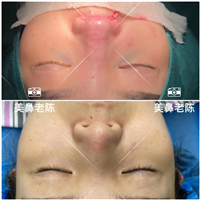 上海鼻部整形医生