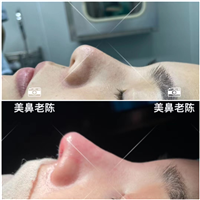 上海整形医生陈坚