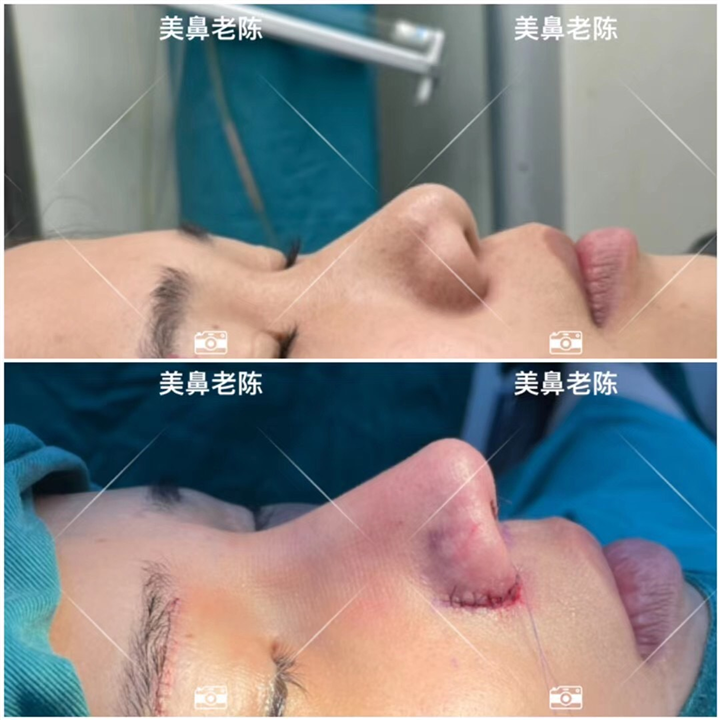 上海鼻王整形