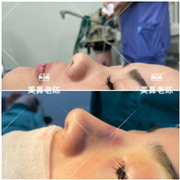 上海鼻王整形医生