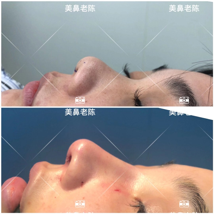 陈坚-整形美容主治医师