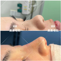 上海鼻王整形医生陈坚