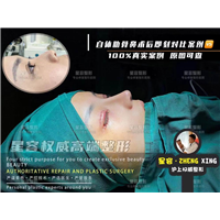 肋骨鼻和双侧耳软隆鼻有什么区别？吸收率怎么样？