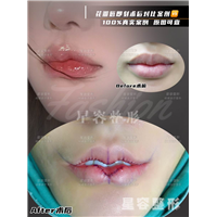 嘴角上扬M唇