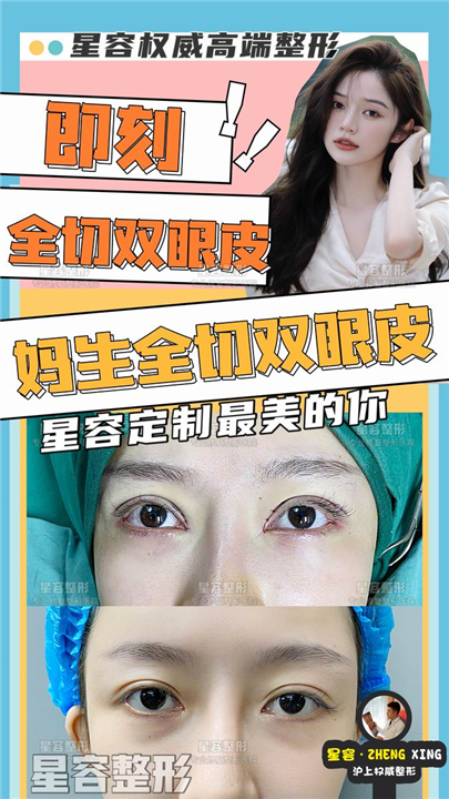 眼部整形后，如何快速消肿？星容整形