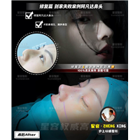 采用肋软做隆鼻能保持多久？肋骨鼻会出现钙化吗？