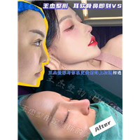 耳软骨整形哪家强