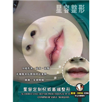 上海做M唇价格