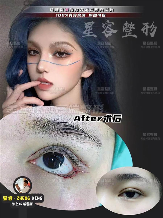上海WJ整形眼部整形项目都有哪些
