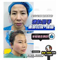拉皮手术的五种方式，你都知道哪些？