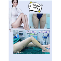 做完大腿吸脂后的处理原则及护理注意事项