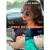人工骨、膨体、硅胶，这三种材料丰下巴谁比较有优势？