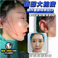 四种常见的皮肤松弛的脸型特点（看看你属于哪种？）