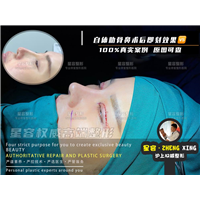 做肋骨鼻身体取出肋软之后，对我们自身有什么影响吗？
