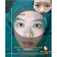 开眼角手术的7大注意事项