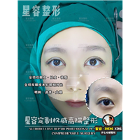 上海WJ整形全切双眼皮