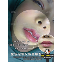 微笑M唇让你甜美不止一个度！!