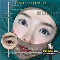 双眼皮/眼综合，面诊攻略
