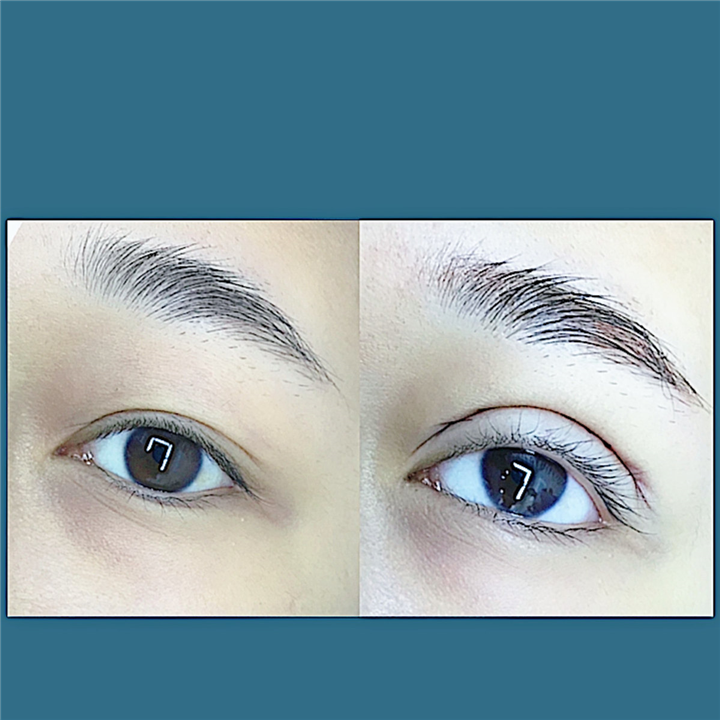 宁波眼综合整形哪家好