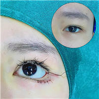 宁波眼综合整形医生