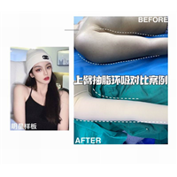 张建波整形医生 