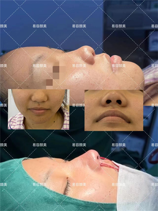 易容颜美李涛