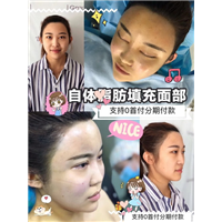 西安网红整形 