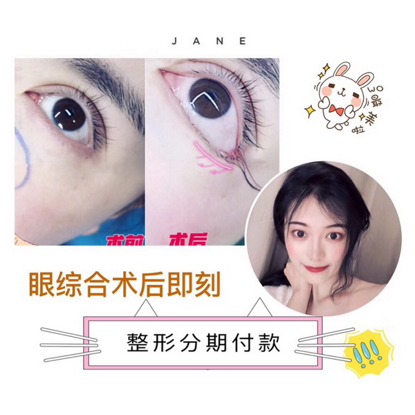 西安妃容整形 