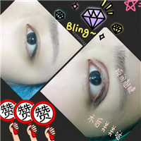 西安眼综合整形 