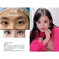 李涛医生