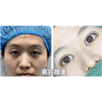 易容颜美李医生
